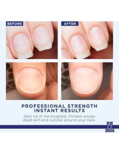 Removedor de Cutículas Líquido Blue Cross 170ml - Suavizante Profesional 2
