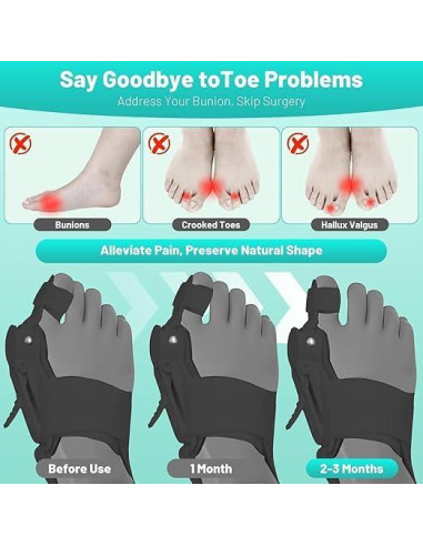 Corrector de Juanetes ETOURER Grande Negro con Almohadilla Silicona