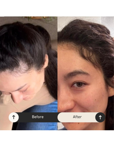 Aceite de Crecimiento y Reparación del Cabello BUR BUR 248g