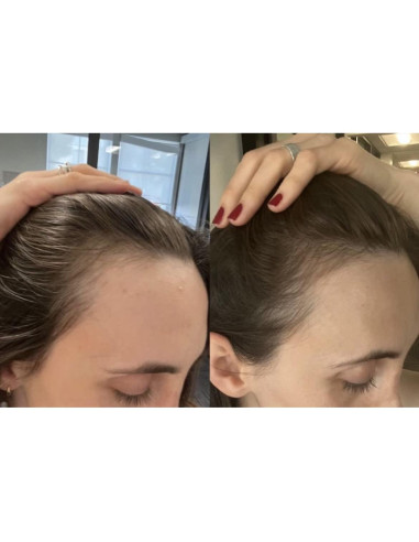 Aceite de Crecimiento y Reparación del Cabello BUR BUR 248g