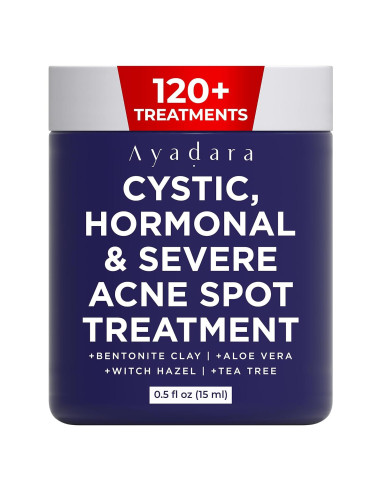 Crema Nocturna Ayadara para Acné Quístico Hormonal 120 Usos