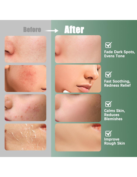 Discos de Tónico Kestper 110 Unidades con Centella Asiática