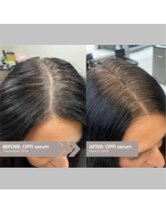 Suero Anti Canas SEVEN Satara Opti 42 ml - Triple Acción 2