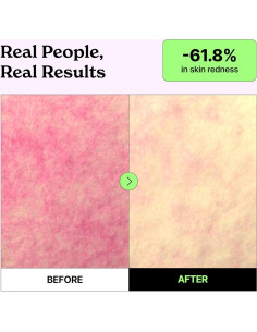 Mascarilla de Colágeno Vividraw PDRN 220g - Antienvejecimiento 2