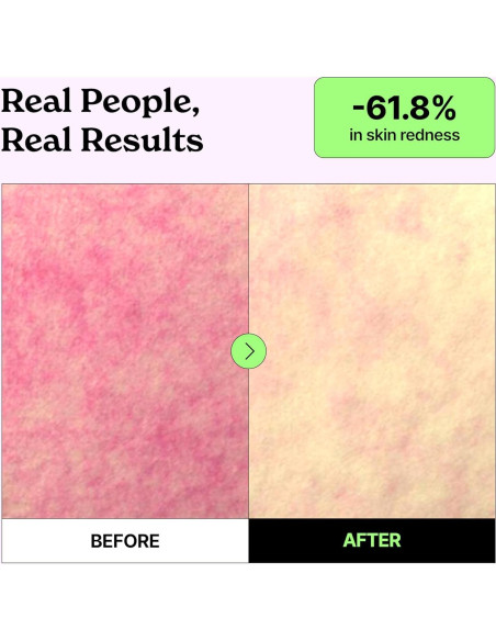 Mascarilla de Colágeno Vividraw PDRN 220g - Antienvejecimiento