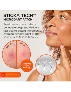 ZitSticka Killa Parches para Acné - 20 Unidades con Microagujas 2