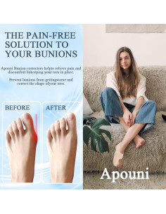 Corrector de Juanetes Apouni Mediano - Alivio Valgus Dedo Gordo 2