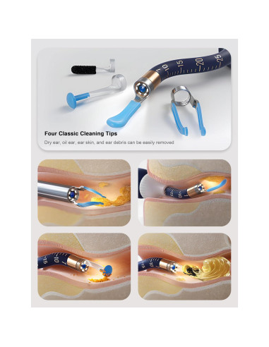 BEBIRD Earsight Plus Kit Limpiador de Cerumen HD WiFi Azul