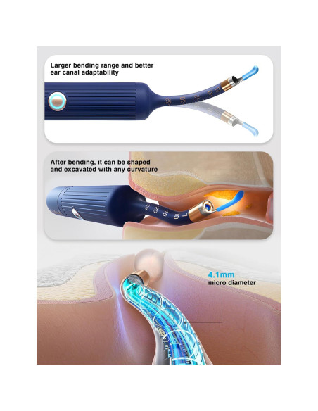 BEBIRD Earsight Plus Kit Limpiador de Cerumen HD WiFi Azul