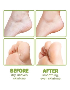 Mascarilla Hidratante para Pies Secos ONSOI 6PK Karité y Oliva 2