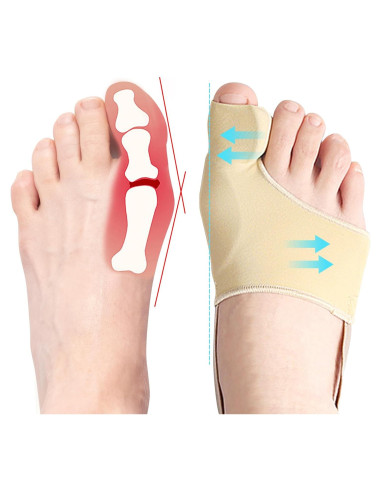 Corrector de Juanetes DFQ 2 Pcs para Alivio y Soporte M