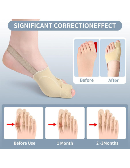 Corrector de Juanetes DFQ 2 Pcs para Alivio y Soporte M