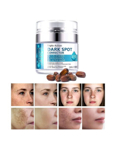 Removedor de Manchas Oscuras SWETIYOU 160g - Unifica Tono Piel