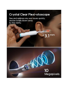 Bebird H30S Limpiador de Oídos con Cámara y Luz UVC 2