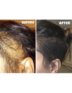 Kit de Crecimiento de Cabello CWHaircare - 2 Piezas Naturales 2