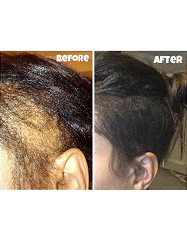 Kit de Crecimiento de Cabello CWHaircare - 2 Piezas Naturales