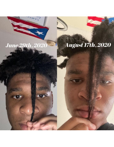 Kit de Crecimiento de Cabello CWHaircare - 2 Piezas Naturales