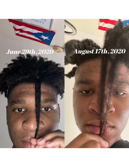 Kit de Crecimiento de Cabello CWHaircare - 2 Piezas Naturales