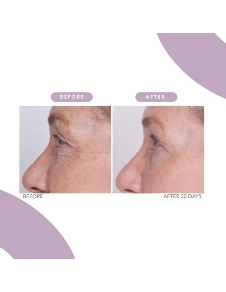 Crema para los Ojos Serious Skincare Reverse Lift 28.35g Crema para los Ojos Serious Skincare Reverse Lift 28.35g