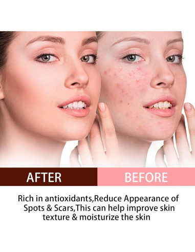 Aceite de Semilla de Rosa Mosqueta Orgánico 120ml - Antienvejecimiento