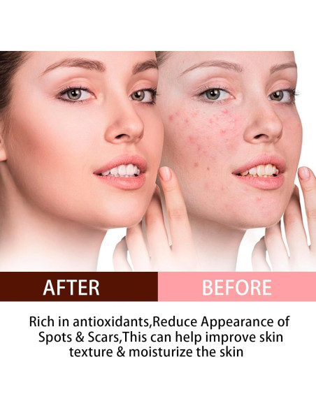 Aceite de Semilla de Rosa Mosqueta Orgánico 120ml - Antienvejecimiento