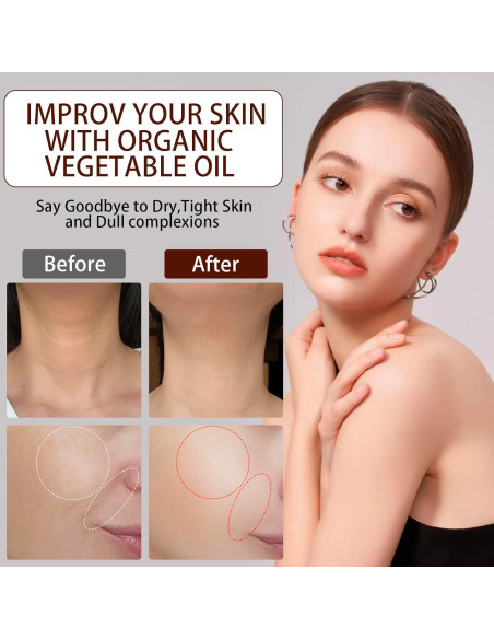 Aceite de Semilla de Rosa Mosqueta Orgánico 120ml - Antienvejecimiento