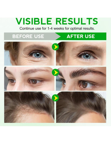 Aceite de Moringa Puro 60ml FSLHCY - Hidratante Facial y Capilar