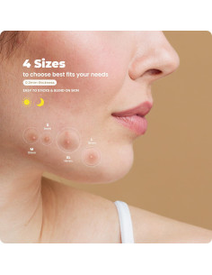 Parches para Granitos RoselynBoutique 300 Piezas Hidrocoloide 2