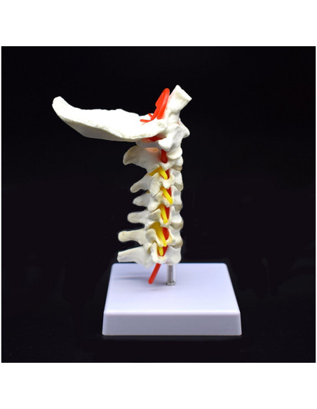 Modelo Anatómico Cervical XINDAM a Tamaño Real PVC