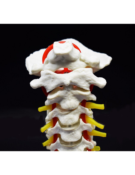 Modelo Anatómico Cervical XINDAM a Tamaño Real PVC