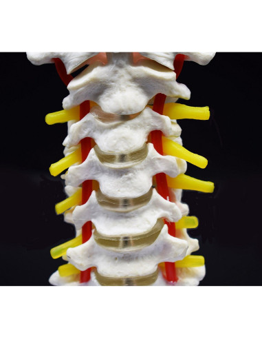 Modelo Anatómico Cervical XINDAM a Tamaño Real PVC