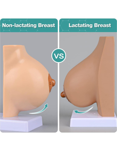 Modelo de Anatomía de Mama Lactante Ultrassist con Tarjeta