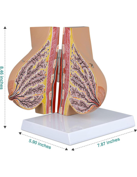 Modelo de Anatomía de Mama Lactante Ultrassist con Tarjeta