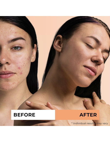 Aceite de Espino Marino Orgánico Jeune Naturelle 59 ml Puro