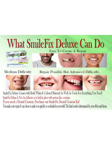 Kit de Reparación Dental SmileFix Deluxe - Herramientas y Perlas