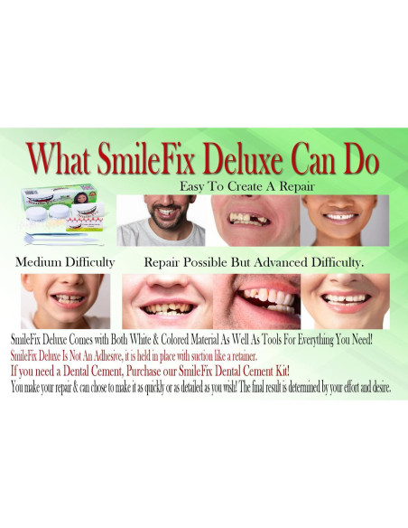 Kit de Reparación Dental SmileFix Deluxe - Herramientas y Perlas