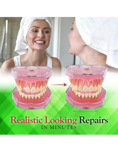 Kit de Reparación Dental SmileFix Deluxe - Herramientas y Perlas