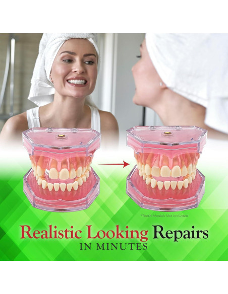 Kit de Reparación Dental SmileFix Deluxe - Herramientas y Perlas