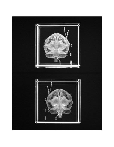 Modelo Anatómico del Cerebro Humano 3D QWORK - Sujetapapeles de Cristal