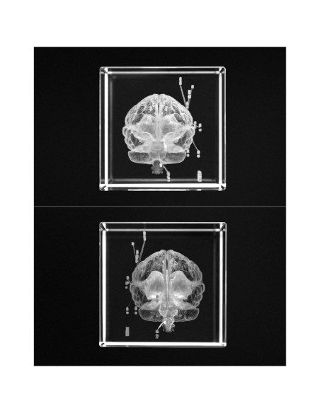 Modelo Anatómico del Cerebro Humano 3D QWORK - Sujetapapeles de Cristal