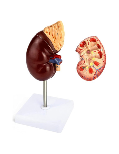 Modelo de Riñón Humano a Tamaño Real QWORK - Educativo