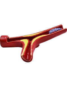 Modelo Anatómico de Vasos Sanguíneos NNSKI 20x17cm 2