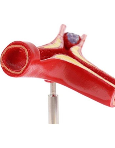 Modelo Anatómico de Vasos Sanguíneos NNSKI 20x17cm