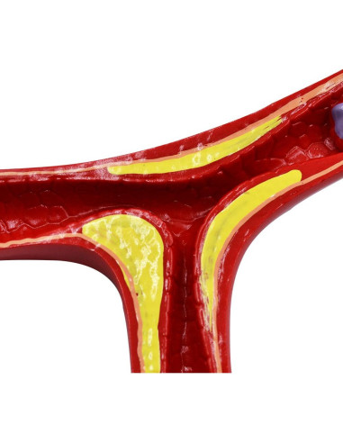 Modelo Anatómico de Vasos Sanguíneos NNSKI 20x17cm