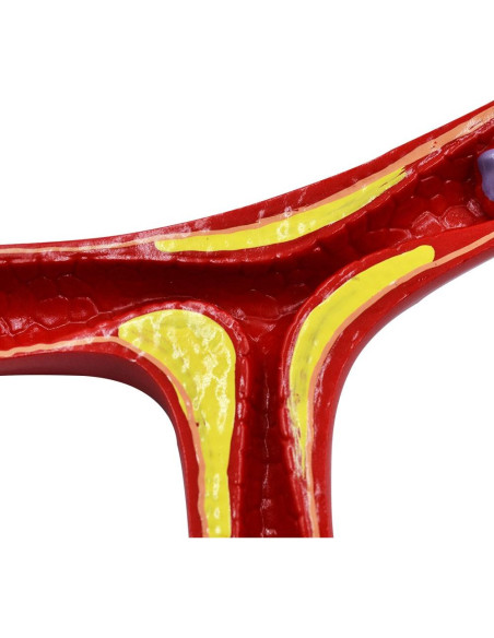 Modelo Anatómico de Vasos Sanguíneos NNSKI 20x17cm