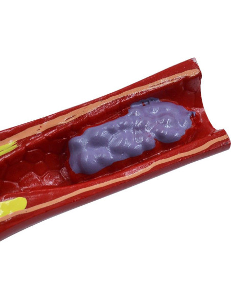 Modelo Anatómico de Vasos Sanguíneos NNSKI 20x17cm