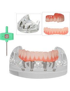 Modelo de Implante Dental Typodont Transparente All-on-4 2