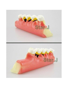 Modelo Typodont Dental Airgoesin para Enfermedad Periodontal 2