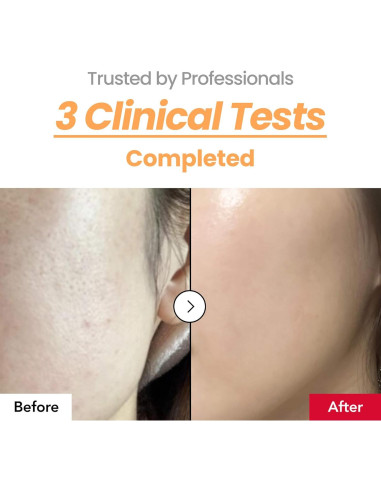 Esencia Hidratante de Textura de Piel Iproduct 150 ml