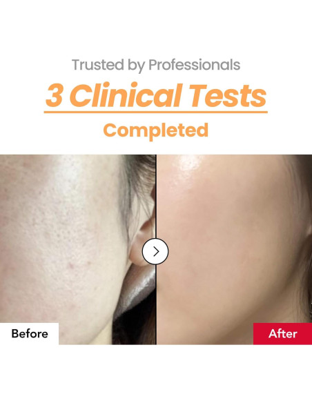 Esencia Hidratante de Textura de Piel Iproduct 150 ml Esencia Hidratante de Textura de Piel Iproduct 150 ml